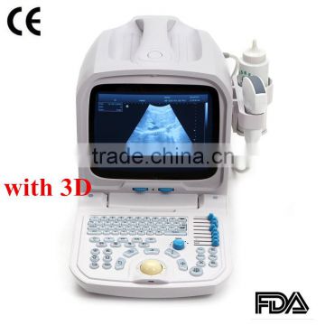 2015 new Full Digital Portable Ultrasound Scanner (PC)