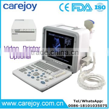 Carejoy Ultrasound Machine portable Ultrasound Scanner with multi frequency probe for hospital clinics community with CE ISO