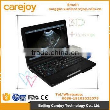 CE approved Laptop Ultrasound machine with Convex Linear Probe price 10 inch external 3D software optional