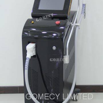 Best Alma Lasers Soprano ICE (the Hair Removal Solution) photo-5