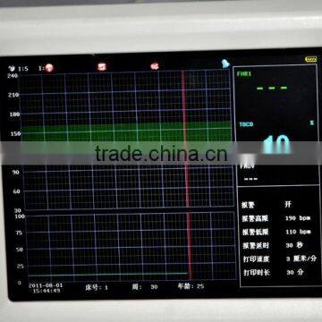 CE/ISO Approved Prenatal Fetal Monitor Fetal Heart Rate Monitoring Single Twins Monitoring Optional Extra Ultrasonic Transducer photo-5