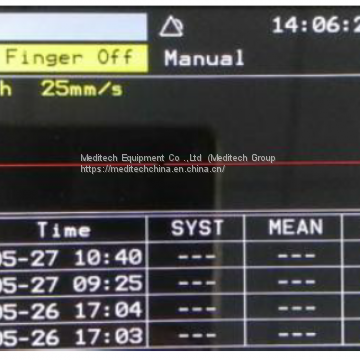 Oxima3 Vital Signs Monitor Three Parameters: NIBP SpO2 and Pulse Rate Ce Approved photo-5