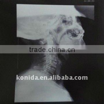 x ray machine accessories,dry image films,medical x-ray film