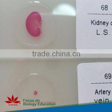 Human pathology system slides Prepared microscope slides set