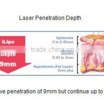 Osano Lipo Laser Cellulite Reduction Treatment Device photo-6