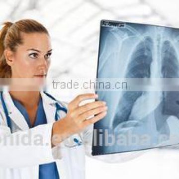 2015 new hot film Fuji medical x-ray film thermal dry film china film blue2015 new hot blue film