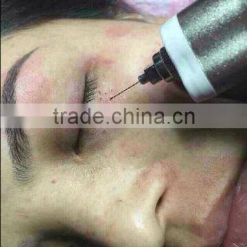2015 Professional Skin Treatment Electrical Machine Plasma Mini Laser for Freckles/Age Spots/,warts Removal Beauty Pen