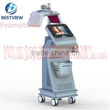 Promotion!!!BM-666 laser for hair loss high level laser therapy machine