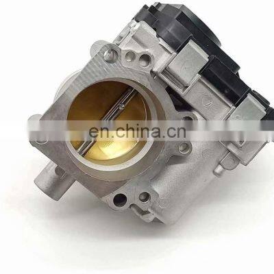 OEM  03C133062M 03C133062Q 03C133062AB Throttle Body 03C133062M 03C133062Q 03C133062AB 04E133062B  for Volkswagen VW Golf