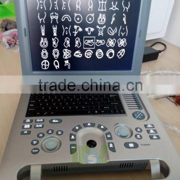 ultrasound machine ,ultrasound machine price,ultrasound scanner