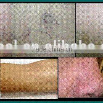 Beijing Fogool 980nm Diode Laser Vascular Removal Veins Removal photo-5