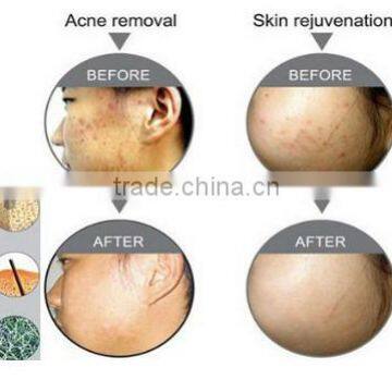 Professional Skin Care Machine photo-5