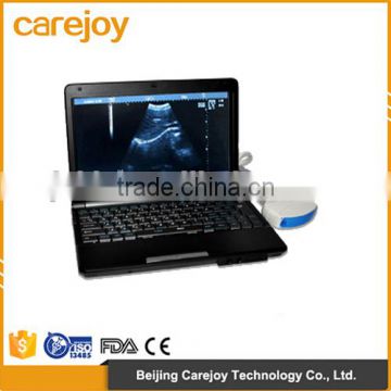 Low factory price!CE approved Laptop Ultrasound Scanner RUS-9000F with 3.5Mhz convex probe