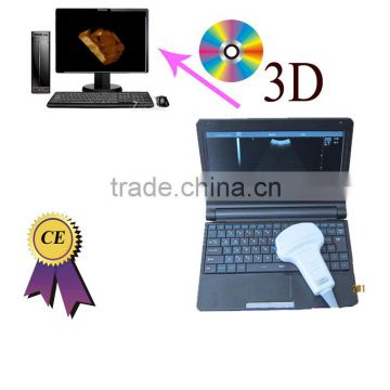 Factory price! CE approved cheap ultrasound scanner with 3.5Mhz convex probe