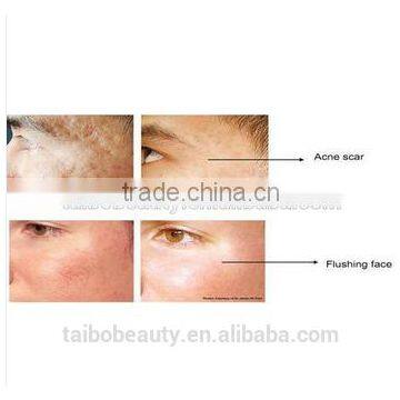 Radio Frequency RF Wrinkle Removal Machine Stretch Mark/best Skin Rejuvenation/ Skin Lifting Radio Frequency photo-6