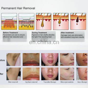 IPL Double Handle For Hair Removal / Skin Rejuvenation Portable Epilation Machine For Sale photo-4