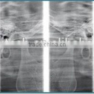 China Cheap Dental Panoramic and Cephalometric X-ray Machine photo-4