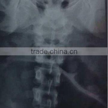 quick ray usb digital x-ray sensor duo size,medical dry film manufacturer,fuji printing machines