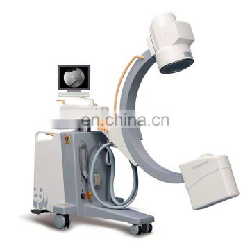 MY-D049V Hospital Device 500mA Digital Mobile Radiography System Medical x Ray Machine Price X-ray Scanner photo-4