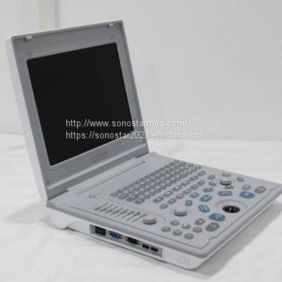 SS-6B Laptop All-Digital Ultrasound photo-2