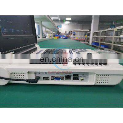 HC-A013C Factory Direct Portable 3D Color Doppler Ultrasound Machine 12 Inch LCD Display Laptop Ultrasound Diagnostic System photo-2