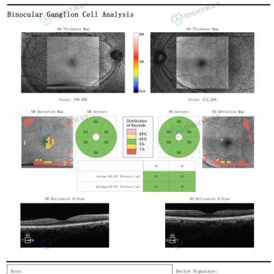 Hot Selling Ophthalmic Medical Equipment OCT-500 Ophthalmic Scanner Optical Coherence Tomography photo-2