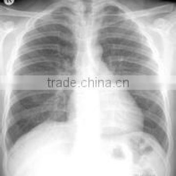 Medical radiology x-ray dry film/Mitsubishi P550DE, x ray dry films, laser film, paper film