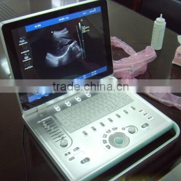 MC-DU-C5 Laptop Color Doppler Ultrasound System SonoScape 4d ultrasound promotion product