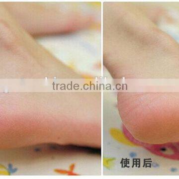 Hot sale foot care product electric callous remover