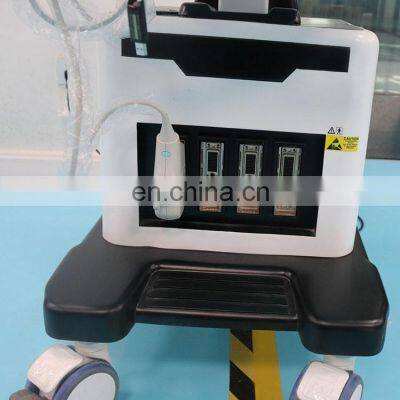 2020 Hot Sale Popular CE Certificate 4D Trolley Color Doppler Ultrasound Machine photo-4