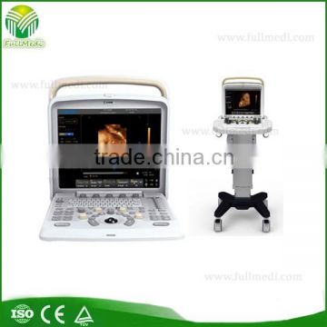 FM-580 portable color doppler ultrasound system