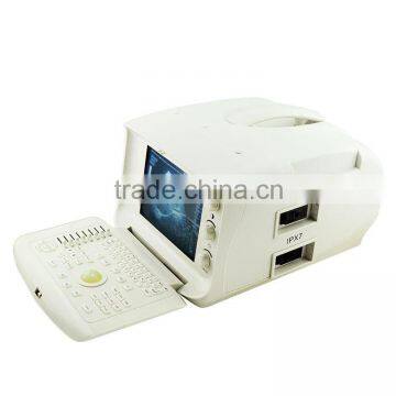 1 USB Factory Price OEM Design 80 Elements R60 Ultrasound Scanner for Pregnancy photo-3