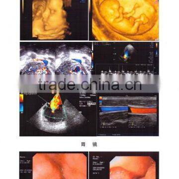 x-ray laser medical films