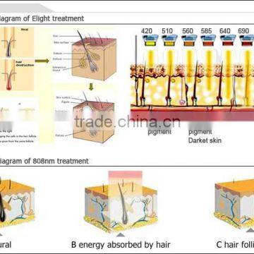 Eye Line Removal Laser Hair Removal Face Lifting  Facial Multifunction Galvanic Spa Beauty Equipment photo-4