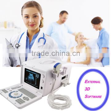 Promotion!!CE approved Notebook/Portable Ultrasound Scanner with 3.5Mhz multi-frequency convex probe RUS-6000D