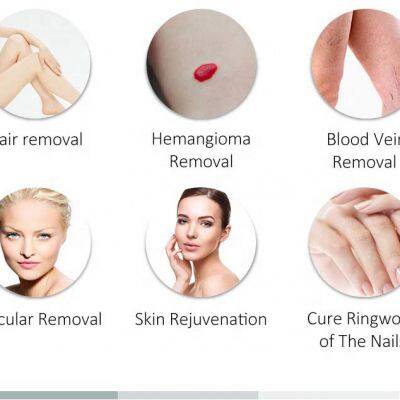 ADM Alexandrite Laser for Face and Body 755nm 1064nm Alexandrite Laser Hair Removal Beauty Machine 755 Alexandrite Laser photo-6