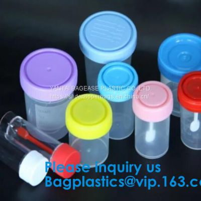 Disposable Urine Specimen Cup/Urine Sample Containers/Urine Collection Cup,Sterile Disposable Hospital Sample 60ml 100