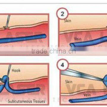 Fast Effective Blood Silk Removal , Vascular Silk Removal Equipment photo-5