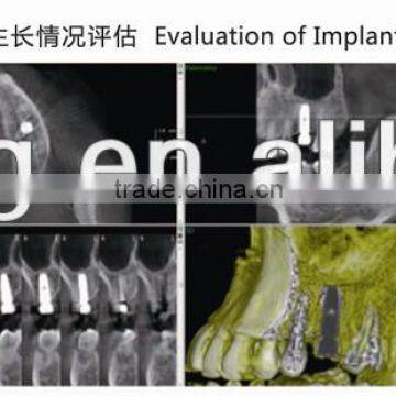 Digital 3D Intra-oral Imaging X-ray Machine
