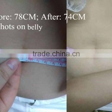 Professional High Frequency Machine 24*24=576 Spots In One Shot High Power Ultrasonic High Frequency  HIFU Focused Ultrasound Body Fat Reduction Slimming Machine Nasolabial Folds Removal photo-3