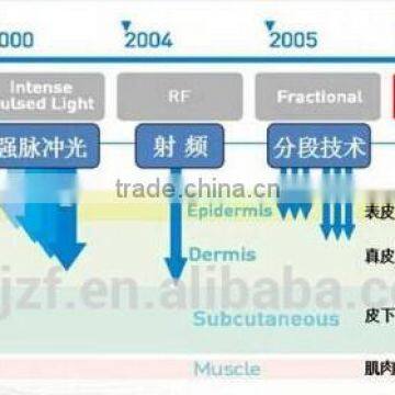 Pigment Removal HIFU-C Professional Ultra Age Beauty Machine High Intensity Focused Ultrasound HIFU 2000 Shots
