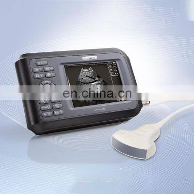 Full Digital Black and White Laptop Doppler Diagnostic System Ultrasound photo-3
