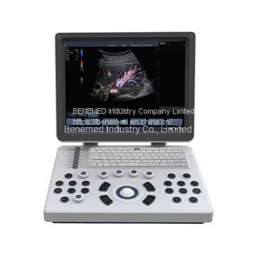 Medical Equipment Ultrasound Scanner Clear Qualtiy Image Bene-3s