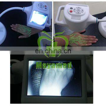 MY-G061 Hot Sale Infrared Angiograph / Medical Portable Vein Finder photo-3
