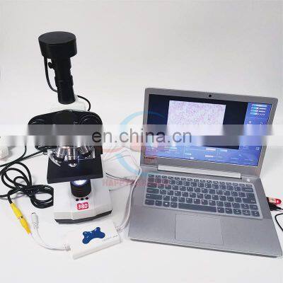 HC-B028V Top 1 Mammal Sperm Quality Analysis System for Veterinary/animal sperm analyzer for dog cat