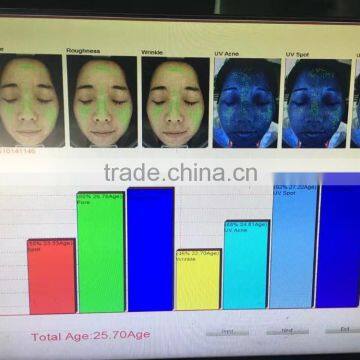 2016 High Quality 3d Magic Mirror Facial Visia Skin Analyzer Magnifier Machine photo-4