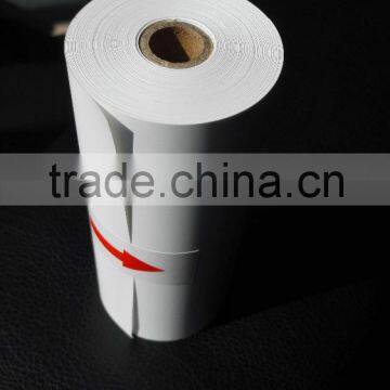 High Quality UPP-110S&UPP-110HG ultrasound thermal paper roll for sony printer