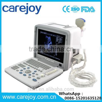 Full Digital LED Ultrasound Scanner B&W ultrasound system