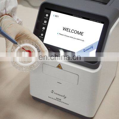 SD1 Blood Test Machines Automatic Blood Gas Electrolyte Chemistry Analyzer