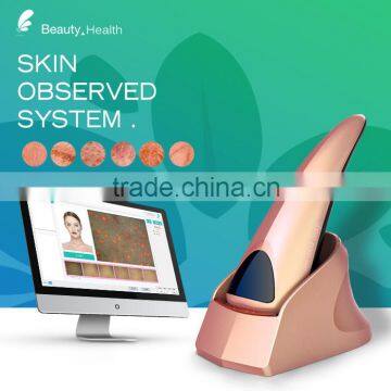 OEM factory New Product Portable Digital Handheld skin analysis machine